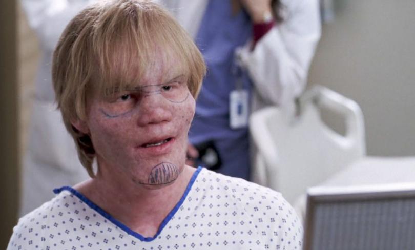 grey's anatomy jesse plemons